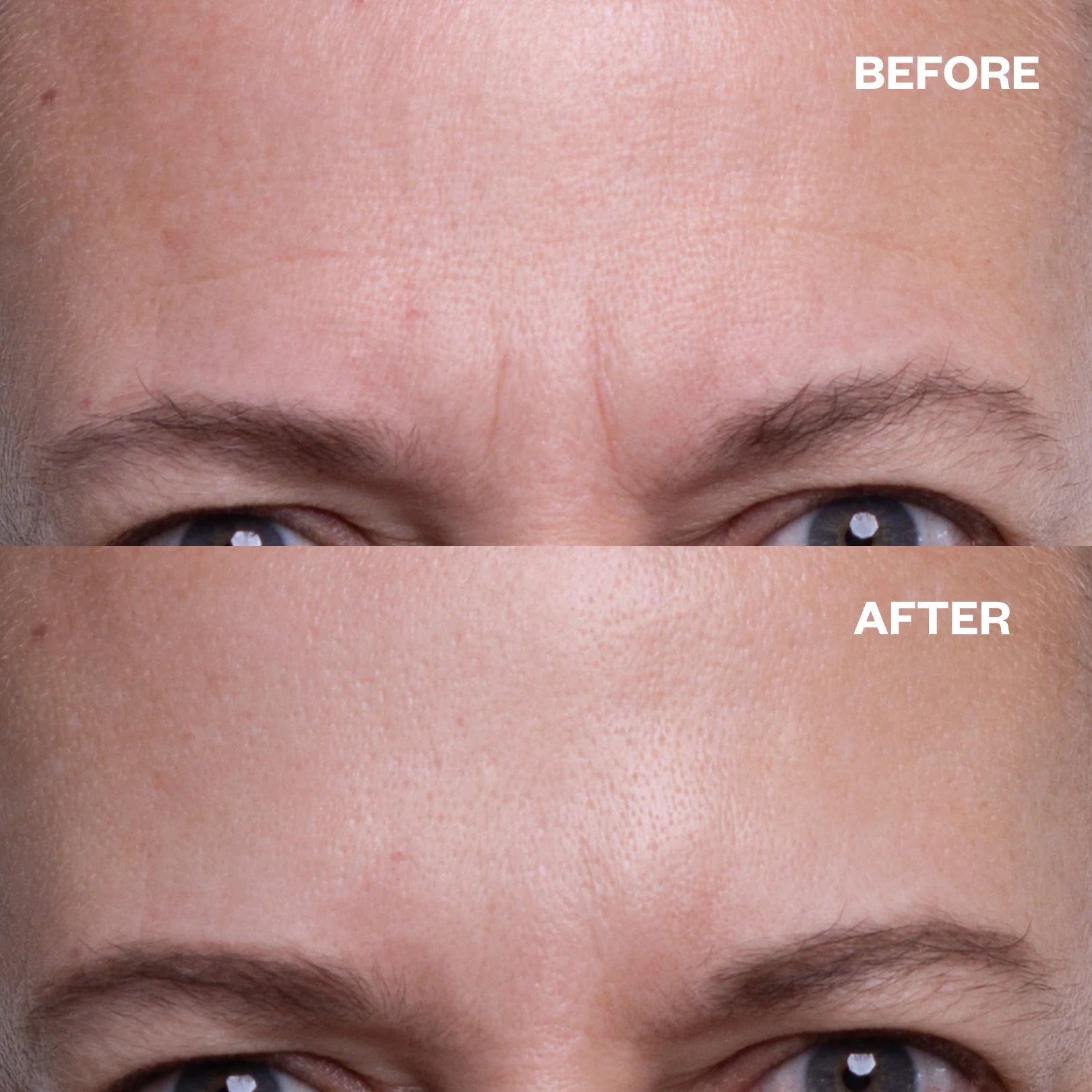 Wrinkles Schminkles Forehead Patches